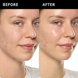 Ectoin Hydro-Barrier Serum - Feuchtigkeitsspendendes und schützendes Serum